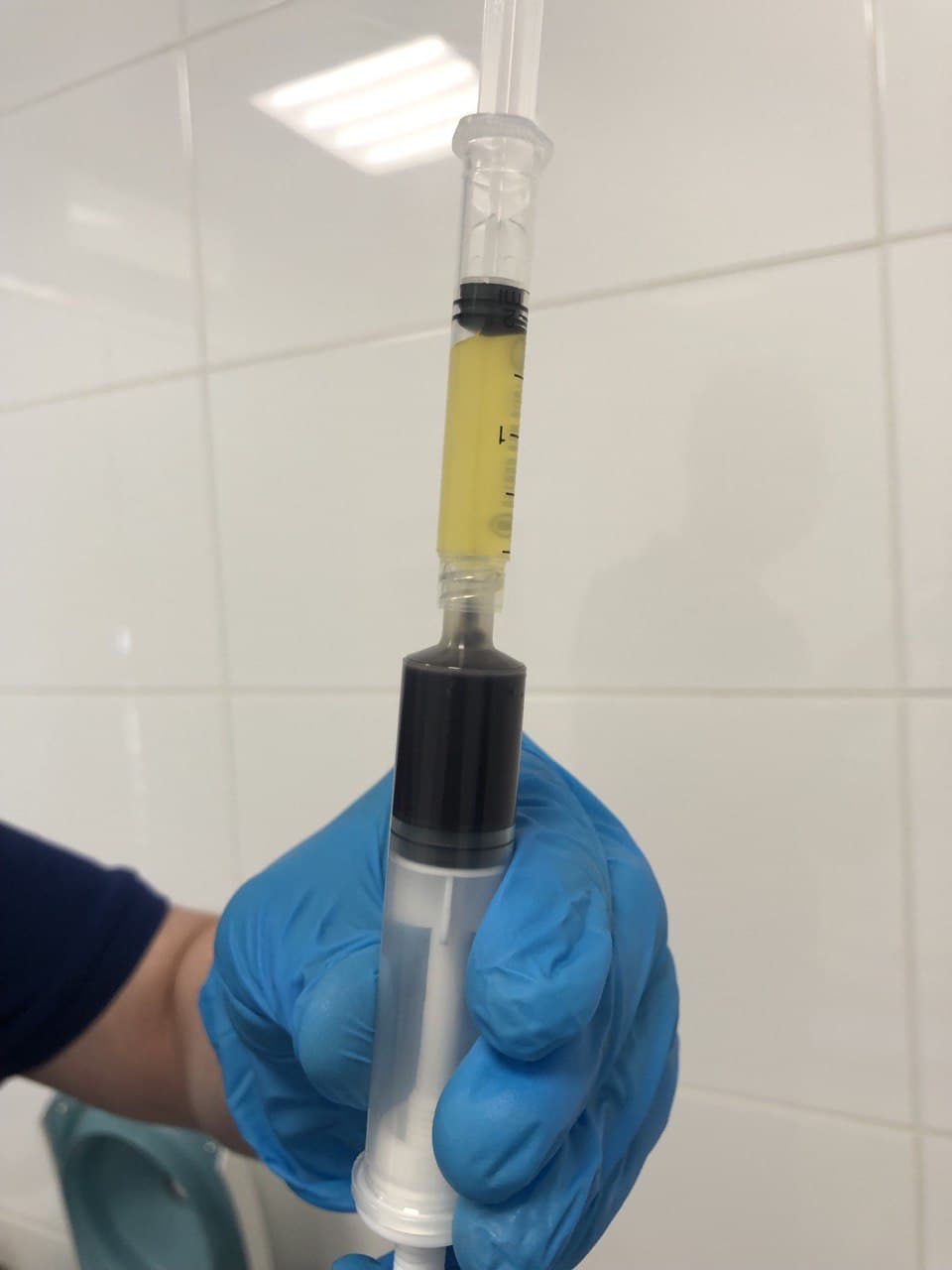 Плазмолифтинг cortexil prp. Prp плазмотерапия. Prp плазмотерапия. Плазмолифтинг где плазмолифтинг. Prp терапия клиники.